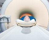 MRI scan